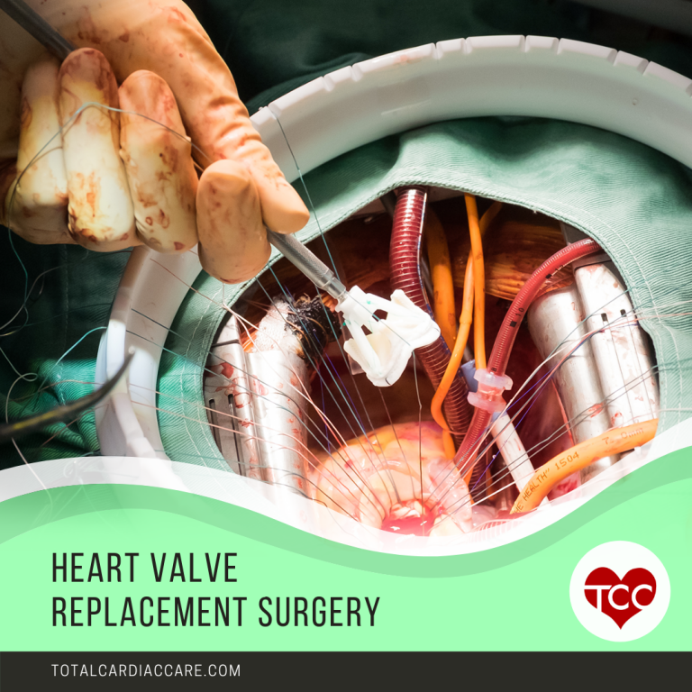 Heart Valve Replacement Surgery Total Cardiac Care By Dr Mahadevan
