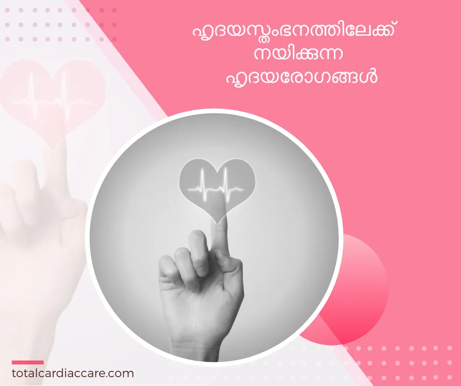 Poster in Malayalam: heart conditions that can lead to cardiac arrest. A finger touching a heart symbol carrying an ECG trace.