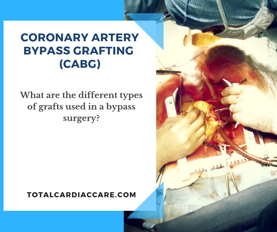 Title card: Coronary artery bypass grafting, CABG. What are the different types of grafts used in a bypass surgery? Over a photograph of an operation in progress.
