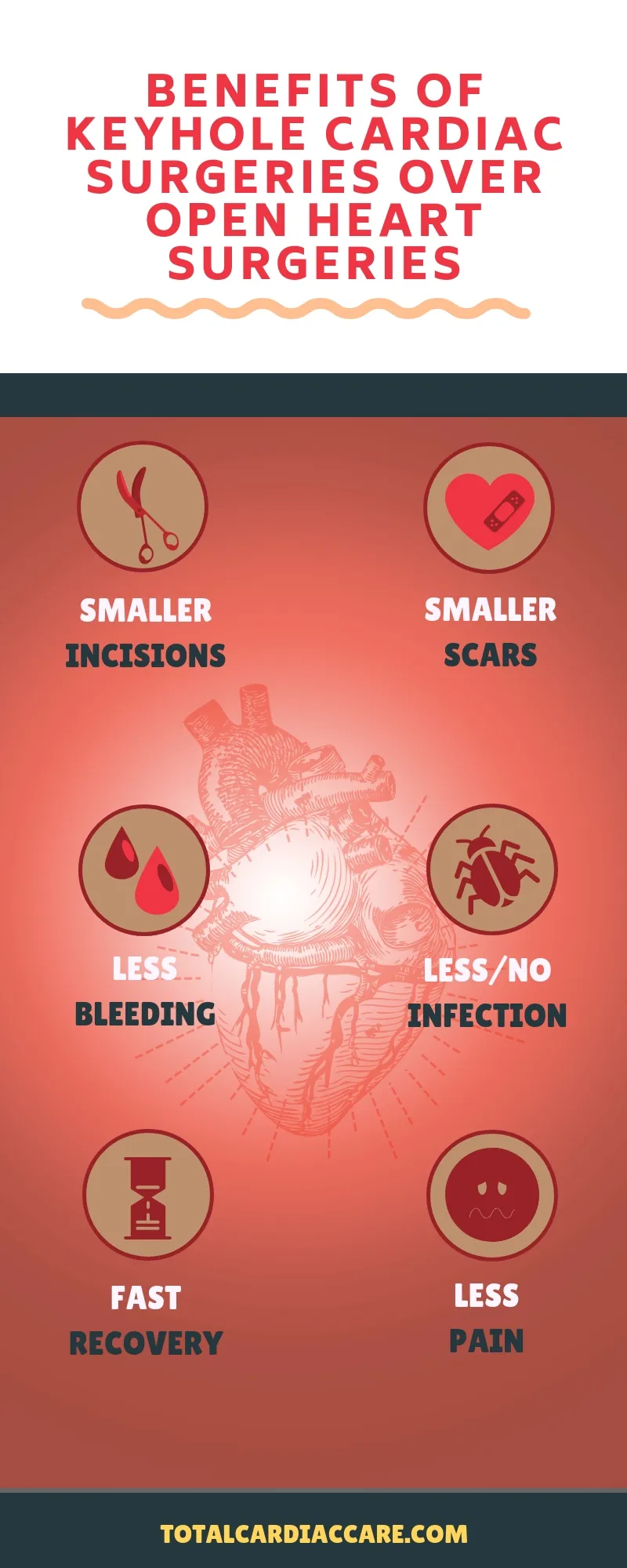 Infographic: Benefits of keyhole cardiac surgeries over open heart surgeries. Smaller incisions, smaller scars, less bleeding, less or no infection, fast recovery, less pain.